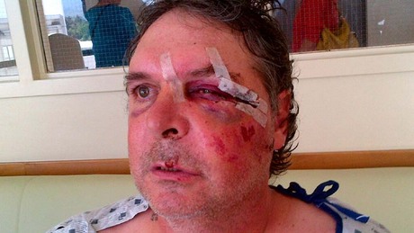 Creston man in Kelowna hospital after altercation with RCMP